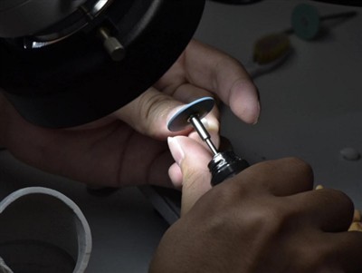 PFM Kronlar Ne Kadar Ömürlüdür? Ortalama Ömür, Faktörler ve Bakım İpuçları